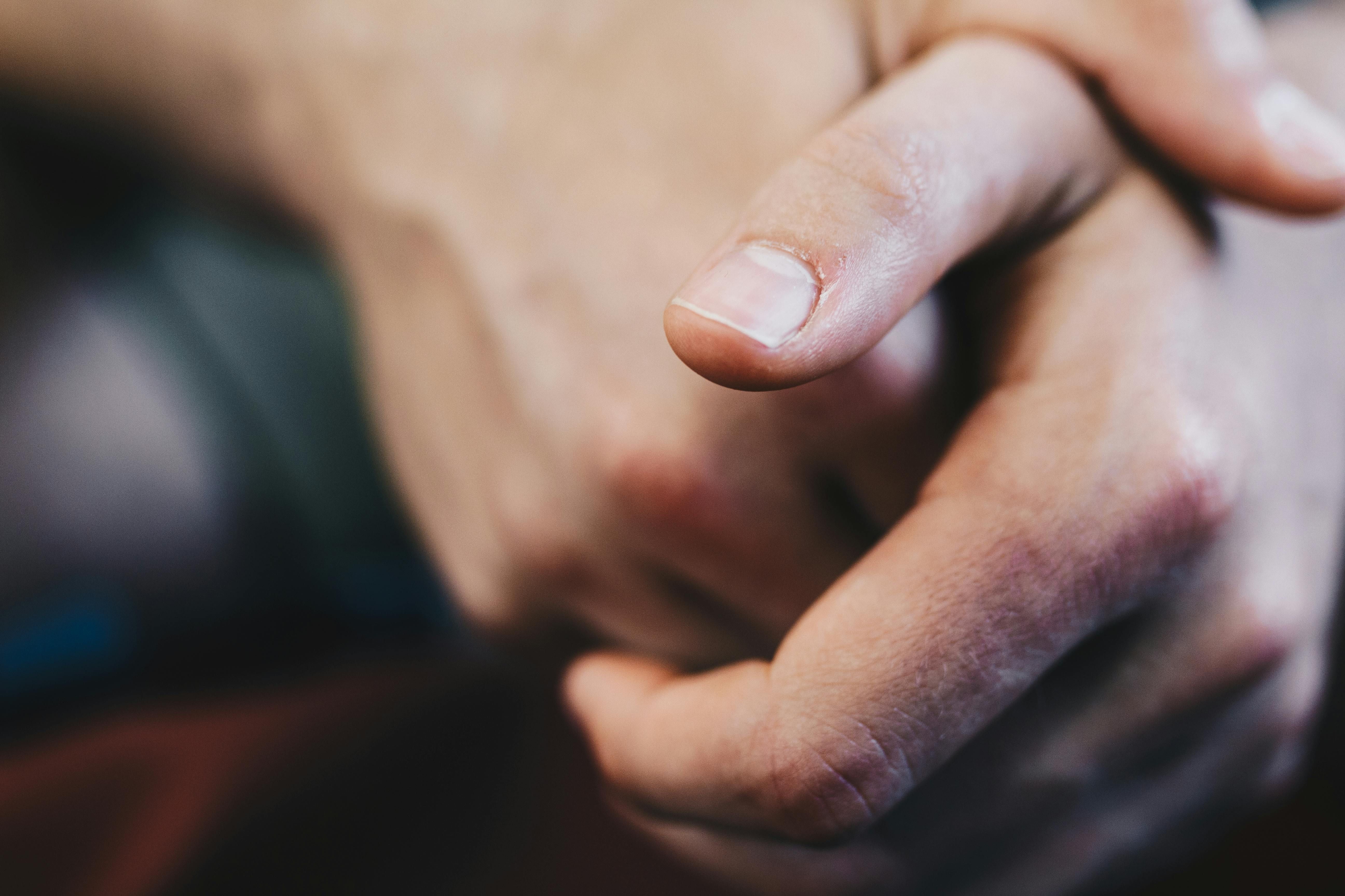 Дефіцит заліза може проявитися на ваших нігтях